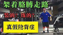 健身房肌肉男架着胳膊走路，隐背症的改善方法！